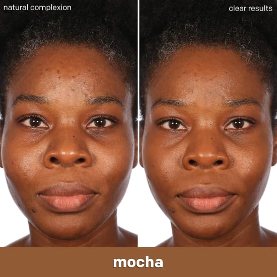 ALMAY Clear Complexion Foundation MOCHA 910 30mL salicylic acid acne treatment N2