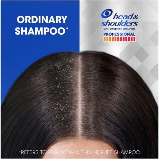 HEAD & SHOULDERS Professional Advanced Itch Care Anti-Dandruff Shampoo scalp5